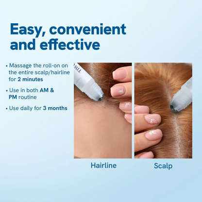 Hair Growth Roll-On Serum – Rosemary 3% | Aminexil 2% | Redensyl 3% | Anagain 2% | Fuller Hair in 4 Weeks