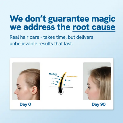 Hair Growth Roll-On Serum – Rosemary 3% | Aminexil 2% | Redensyl 3% | Anagain 2% | Fuller Hair in 4 Weeks